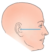 The topographic line identified in the figure below is the:   A)  orbitomeatal. B)  mentomeatal. C)  acanthiomeatal. D)  infraorbitomeatal.