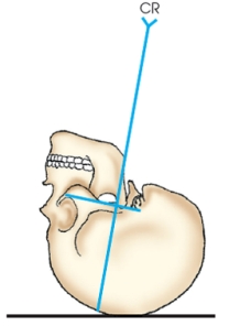 The x-ray projection demonstrated in the figure below is the:   A)  SMV. B)  VSM. C)  AP axial. D)  PA axial.