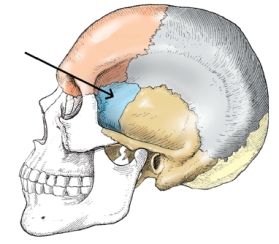 The bone identified on the skull below is the:   A)  temporal. B)  parietal. C)  zygoma. D)  sphenoid.