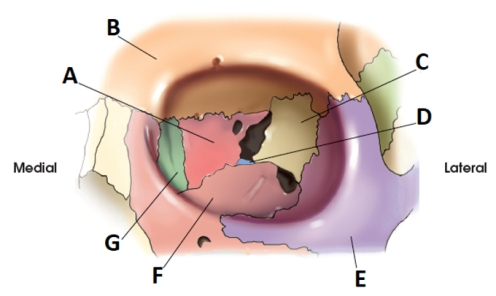 Letter C in the diagram below of the orbit labels the:   A)  ethmoid. B)  sphenoid. C)  lacrimal. D)  maxilla.