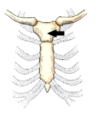 The anatomic part of the sternum identified in the figure below is the:   A)  xiphoid. B)  jugular notch. C)  manubrium. D)  sternal angle.