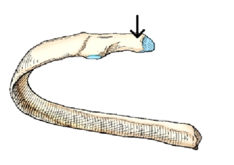 The part of the rib identified in the figure above is the:   A)  head. B)  neck. C)  facet. D)  shaft.