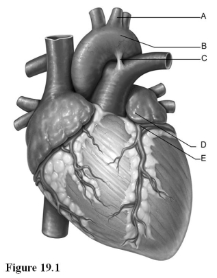   Use the diagram above to answer the following questions. -Identify the letter that indicates the aortic arch. A)  A B)  B C)  C D)  D E)  E