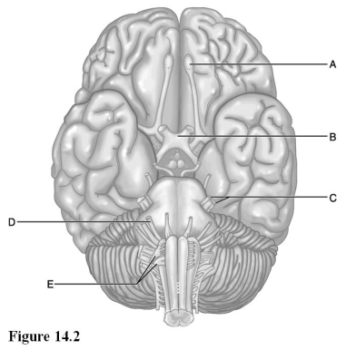   Use the diagram above to answer the following questions. -Sensory fibers of which cranial nerve pair pass through the cribriform plate of the ethmoid bone? A)  I B)  II C)  IV D)  V E)  VIII