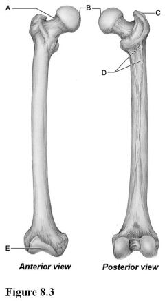   Use the diagram above to answer the following questions. -Which letter indicates a depression that is the site where a femoral ligament attaches to the acetabulum? A)  A B)  B C)  C D)  D E)  E