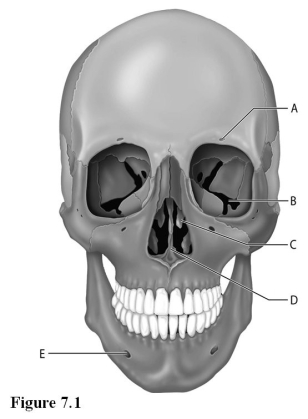   Use the diagram above to answer the following questions. -Which letter indicates the supraorbital foramen? A)  A B)  B C)  C D)  D E)  E