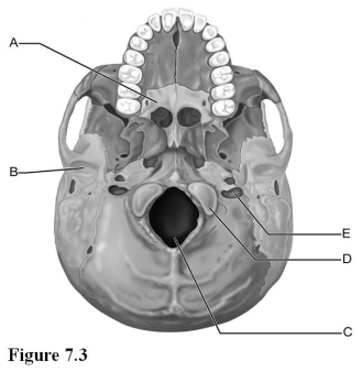   Use the diagram above to answer the following questions. -Which letter indicates the mandibular fossa of the temporal bone? A)  A B)  B C)  C D)  D E)  E