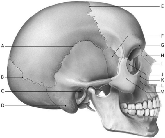   Figure 6-2 Adult Skull (Lateral View)  Use Figure 6-2 to identify the labeled part. -Structure B is the joint between the ________ and ________ bones. A)  occipital; temporal B)  occipital; parietal C)  parietal; frontal D)  frontal; occipital E)  temporal; parietal