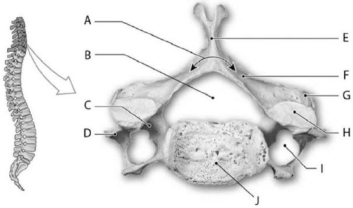   Photo Credit: Ralph T. Hutchings Figure 6-3 A Cervical Vertebra (Superior View)  Use Figure 6-3 to identify the labeled part. -The bones that form the palms of the hands are the A)  carpals. B)  tarsals. C)  metacarpals. D)  metatarsals. E)  phalanges.