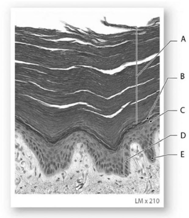  Photo Credit: Robert B. Tallitsch Figure 5-2 The Strata of the Epidermis in Thick Skin Use Figure 5-2 to answer the following questions: -The layer marked A is the A)  stratum basale. B)  stratum corneum. C)  stratum lucidum. D)  stratum spinosum. E)  stratus germinativum.