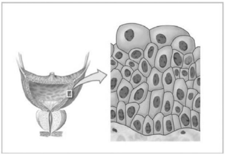   Figure 4-3 Epithelial Tissue Use Figure 4-3 to answer the following question: Identify the type of epithelial tissue shown in the figure. A)  simple squamous B)  stratified squamous C)  pseudostratified ciliated columnar D)  simple cuboidal E)  transitional
