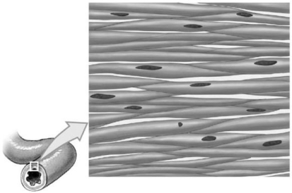   Figure 4-5 A Tissue Use Figure 4-5 to answer the following questions: -Identify the tissue in the image, which is comprised of short, spindle-shaped cells that are found in the walls of blood vessels and in digestive, respiratory, urinary, and reproductive organs. A)  fibrocartilage B)  dense regular connective tissue C)  smooth muscle tissue D)  reticular tissue E)  cardiac muscle tissue