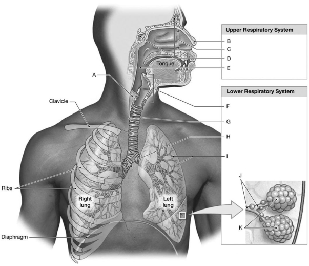   Figure 15-1 Components of the Respiratory System Use Figure 15-1 to identify the labeled part. -Label J represents which structure(s) ? A)  trachea B)  smallest bronchioles C)  bronchus D)  alveoli E)  bronchioles