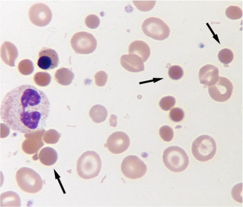 Identify the poikilocytes indicated by the arrows in the following image.   A)  Acanthocytes B)  Drepanocytes C)  Schizocytes D)  Spherocytes