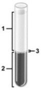 Predictions related to homeostatic imbalance, including disease states & disorders.   -In the centrifuged sample of blood illustrated, which number indicates the layer containing water, plasma proteins, nutrients, and waste products? A)  1 B)  2 C)  3 D)  None of the numbers indicate that component of blood.
