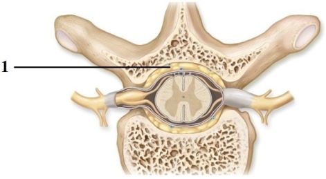 This figure shows a cross section of a vertebra and the spinal cord. What structure does number 1 indicate?   A)  Epidural space B)  Pia mater C)  Subarachnoid space D)  Central canal E)  Dura mater