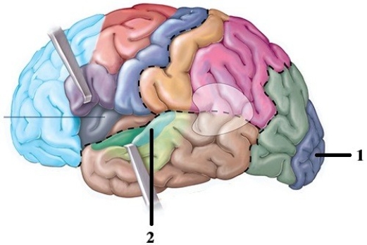 Division, origin, & function of component parts of the brain.   -This figure shows the lobes of the cerebrum. What structure does number 2 indicate? A)  Primary auditory cortex B)  Primary olfactory cortex C)  Primary gustatory cortex D)  Primary visual cortex E)  Primary motor cortex