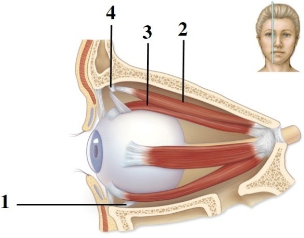   -This figure shows a medial view of the right eye. What muscle does number 3 indicate? A)  Superior oblique B)  Inferior oblique C)  Lateral rectus D)  Medial rectus E)  Superior rectus