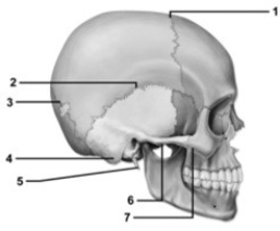   -This figure shows a lateral view of the skull. What bone is visible within the suture indicated by number 3? A)  Wormian bone B)  Sesamoid bone C)  Pterygoid bone D)  Condylar bone E)  Lambdoid bone