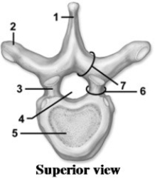   -This figure shows a superior view of a vertebra. What feature is indicated by number 4? A)  Transverse foramen B)  Intervertebral foramen C)  Vertebral hiatus D)  Neural canal E)  Vertebral foramen