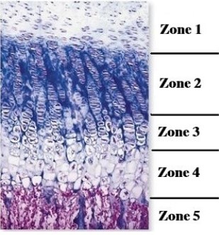   -This figure illustrates epiphyseal plate morphology. Which is the zone of proliferating cartilage? A)  1 B)  2 C)  3 D)  4 E)  5