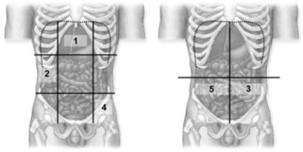   -These figures show a frontal view of the abdominopelvic cavities. Which number indicates the epigastric region? A)  1 B)  2 C)  3 D)  4 E)  5