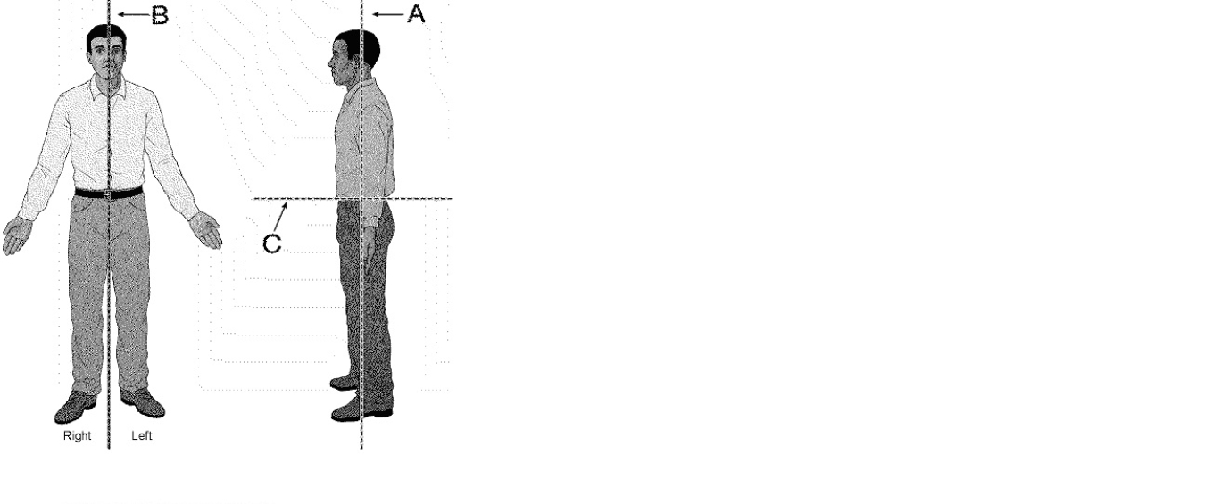 Match each body plane in the drawing with its name mentioned next.​    -​Transverse