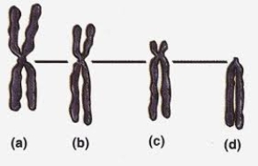 Which chromosome in the following figure is MOST likely to be described as acrocentric?   A)  (a)  B)  (b)  C)  (c)  D)  (d)  E)  Chromosomes (a)  and (b)  are both acrocentric.
