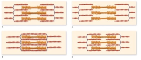 According to the figure,which one represents the muscle in an optimal condition for a strong contraction?   A) A B) B C) C D) D