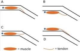 The figure below represents a joint in the hind leg of a grasshopper.The exoskeleton of the leg is indicated by the two pairs of parallel black lines.A muscle that moves this leg is fixed to the skeleton at the end marked with a blue star.When the muscle contracts,it will pull on the tendon at its opposite end.Which configuration shows the most likely arrangement of the exoskeleton and a muscle that increases the flexion of this leg?   A) A B) B C) C D) D