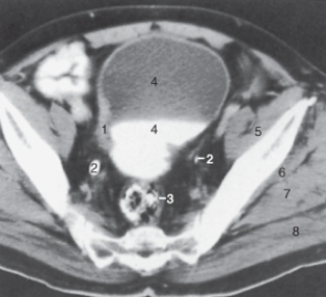 The structure labeled as 3 is the:   A)  anus. B)  sigmoid colon. C)  cecum. D)  duodenum.
