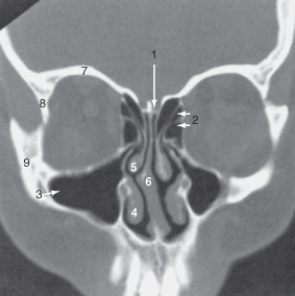 The ethmoid sinuses are labeled:   A) 2. B) 3. C) 4. D) 5.