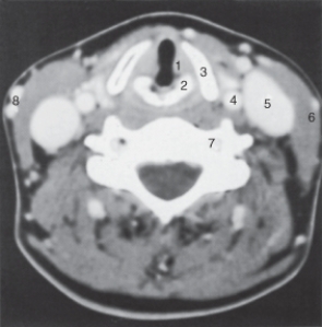 The thyroid cartilage is labeled:   A) 1. B) 2. C) 3. D) 6.