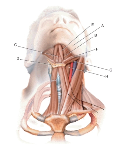 Match the terms or descriptions to the muscle, landmark, or structure in the following figure.   -Hyoid corpus