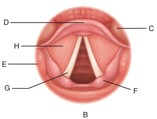 Match the terms or descriptions to the muscle, landmark, orientation, or structure in the following figure.   -Anterior