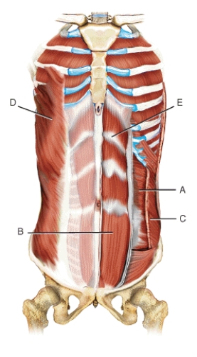 Identify the muscles indicated on the following figure using the letters provided. Letters may be used more than once or not at all.   -Internal oblique abdominis
