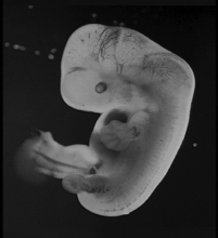 Examine the Embryo in the Figure | Biology+