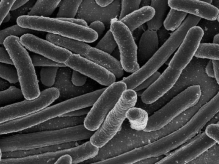 What kind of prokaryotes are shown in the figure?   A) bacilli B) spirochetes C) cocci D) ciliates