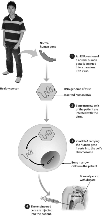 The diagram below summarizes ________.   A) gene cloning B) how a human could be cloned C) human gene therapy D) how a vaccine is made