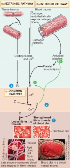 The end-product of stage 2 of the clotting cascade (labeled D in the diagram) is an activated enzyme called   A) fibrinogen B) carbonic anhydrase C) prothrombinase D) prothrombin E) thrombin