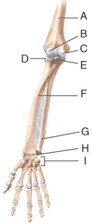 Which of the labeled bones in the diagram is a metacarpal?   A) A B) G C) I D) F E) B