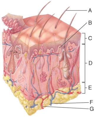 Which of the following does NOT accurately describe the region labeled C in the diagram?   A) most superficial layer of the skin B) stratified cuboidal epithelium C) contains the protective protein called keratin D) made up of 4 to 5 layers of cells E) contains 4 principal types of cells