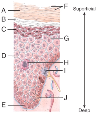Which of the labeled epidermal cells in the diagram helps the immune system to recognize foreign microbes present in the skin?   A) F B) G C) H D) I E) J