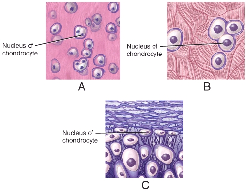 Which of the diagrams shows a type of connective tissue commonly found in the auricle of the external ear?   A) A B) B C) C D) A and C E) All three diagrams show types of connective tissue found in external ear.