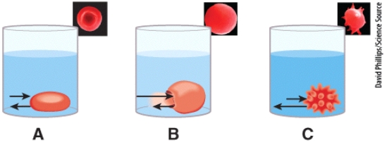 Which diagram and picture in the figure best represents the results obtained when placing red blood cells into a normal saline solution (0.9% NaCl)?   A)A B)B C)C D)None of the choices is correct. E)All of the choices are correct.