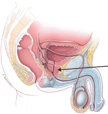 What is the structure indicated in the figure?   A)  urinary bladder B)  testis C)  bulbourethral gland D)  prostate