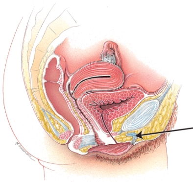 What structure is indicated in the diagram?   A)  ovary B)  uterus C)  vagina D)  clitoris