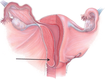 What is the name of the structure indicated in the diagram?   A)  fimbriae of uterine tube B)  isthmus of uterine tube C)  cervix of uterus D)  fundus of uterus