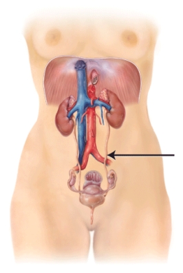 What is the structure that is indicated on the diagram?   A)  right renal artery B)  left renal vein C)  left ureter D)  left urethra