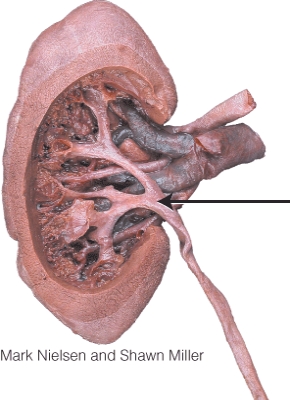 What is the structure indicated in the diagram?   A)  renal pelvis B)  minor calyx C)  renal vein D)  major calyx
